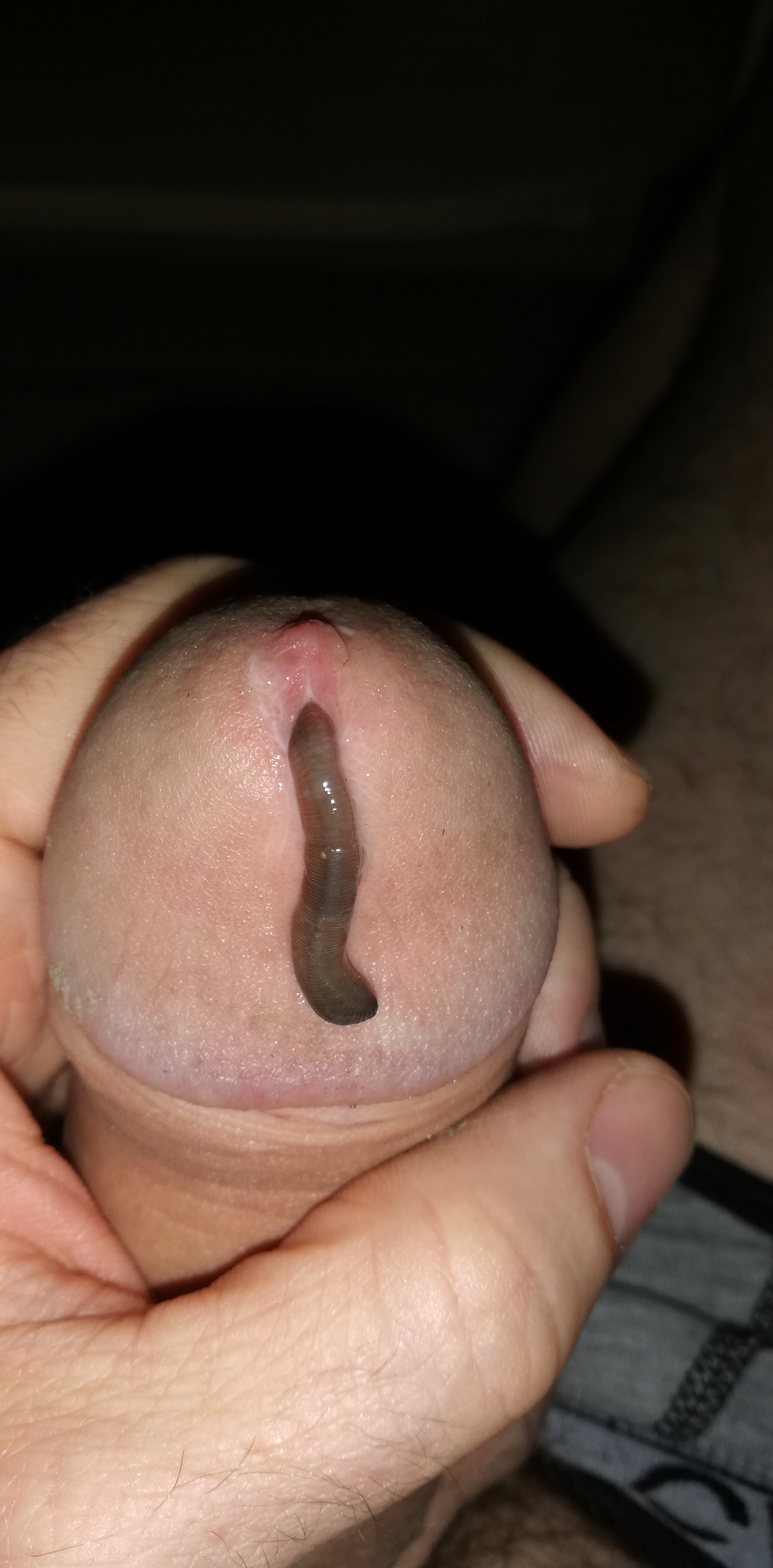 Game with worm — 20